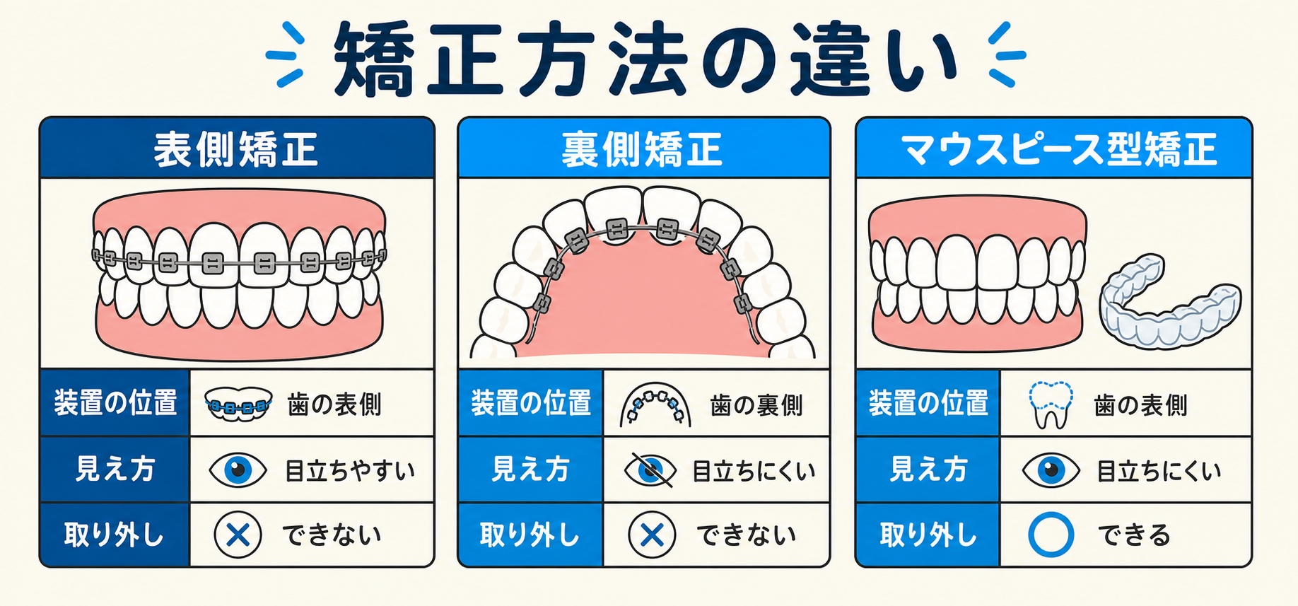 表側矯正、裏側矯正、マウスピース型矯正の装置の位置や見え方、取り外しの可否を比較したインフォグラフィック。
