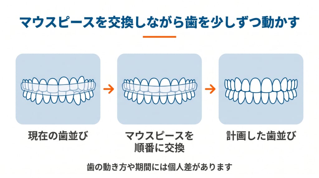 マウスピースを交換しながら歯を少しずつ動かす