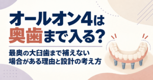 オールオン4は奥歯まで入る？最奥の大臼歯まで補えない場合がある理由と設計の考え方