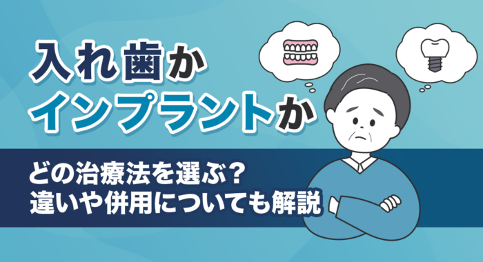 入れ歯とインプラントの違いは？どっちがいいか選び方と総入れ歯・部分入れ歯・併用まで解説