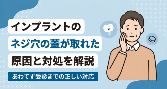 インプラントのネジ穴の蓋が取れたときの原因と対処を解説｜あわてず受診までの正しい対応