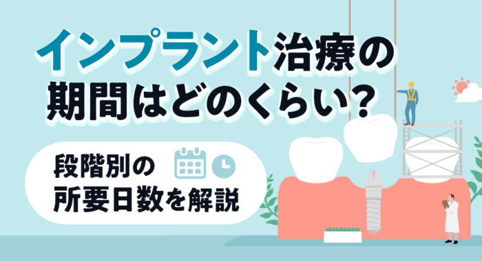 インプラント治療の期間はどのくらい？段階別の所要日数を解説