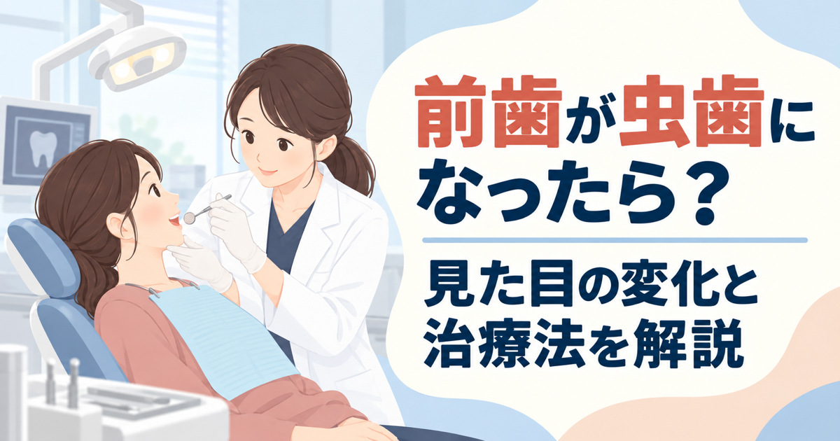 歯科医院の診療台で口を開けた女性の前歯を女性歯科医師が診察しているイラストに、前歯が虫歯になったときの見た目の変化と治療法を解説する文字を添えた画像