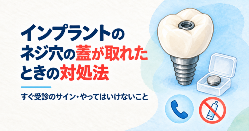 インプラントの人工歯の断面（ネジ穴と蓋）、取れた蓋を入れる保管ケース、歯科医院へ連絡する受話器のイラスト