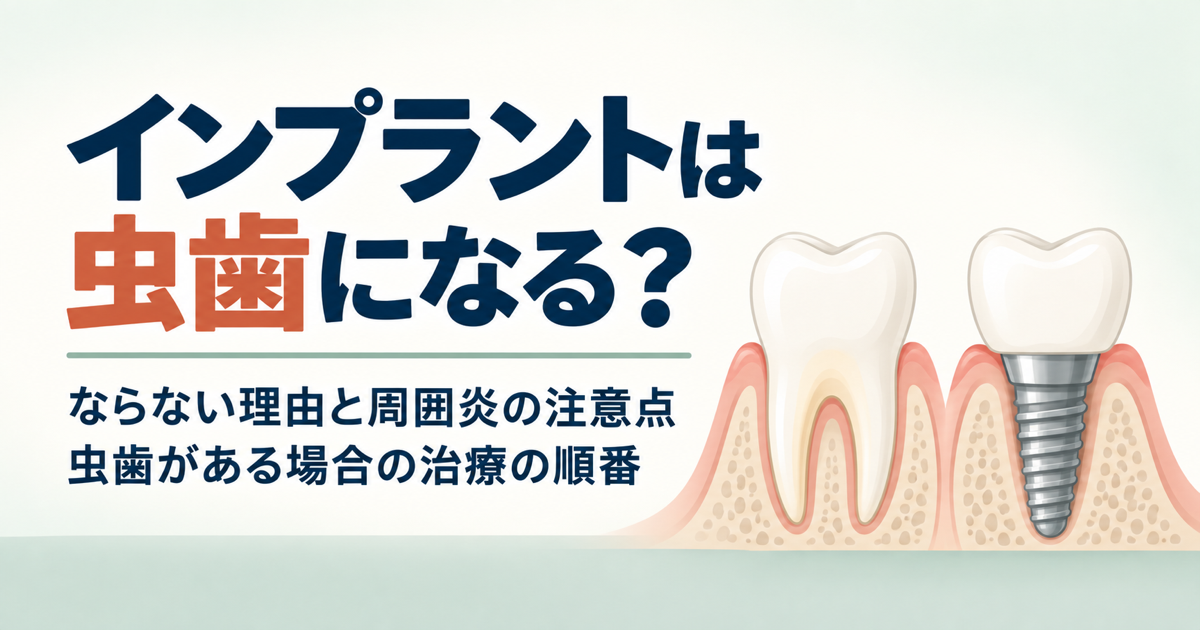 虫歯になった天然歯とインプラントを比較したイラスト