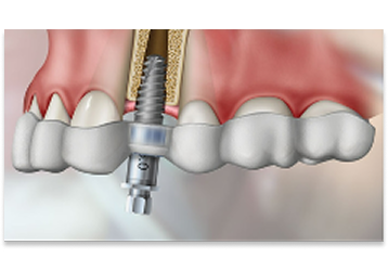 溝の口佐和歯科・矯正歯科・口腔外科のイメージ01
