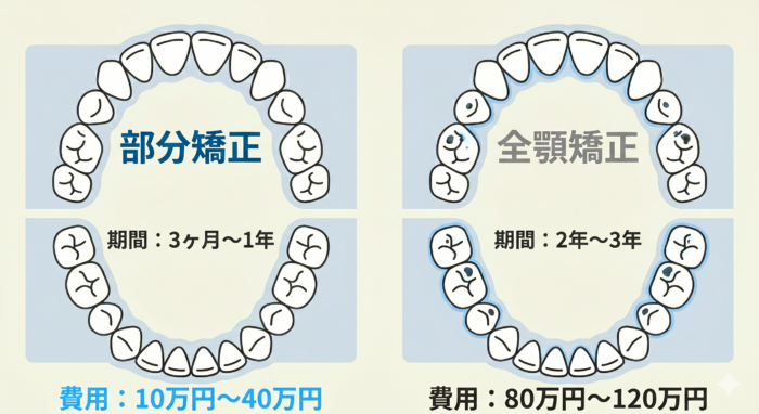 マウスピース矯正における「部分矯正（中核エンティティ）」と「全顎矯正（派生エンティティ）」の治療範囲、費用、期間の違いを比較したインフォグラフィック。