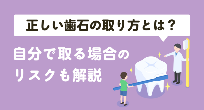 正しい歯石の取り方とは？自分で取る場合のリスクも解説