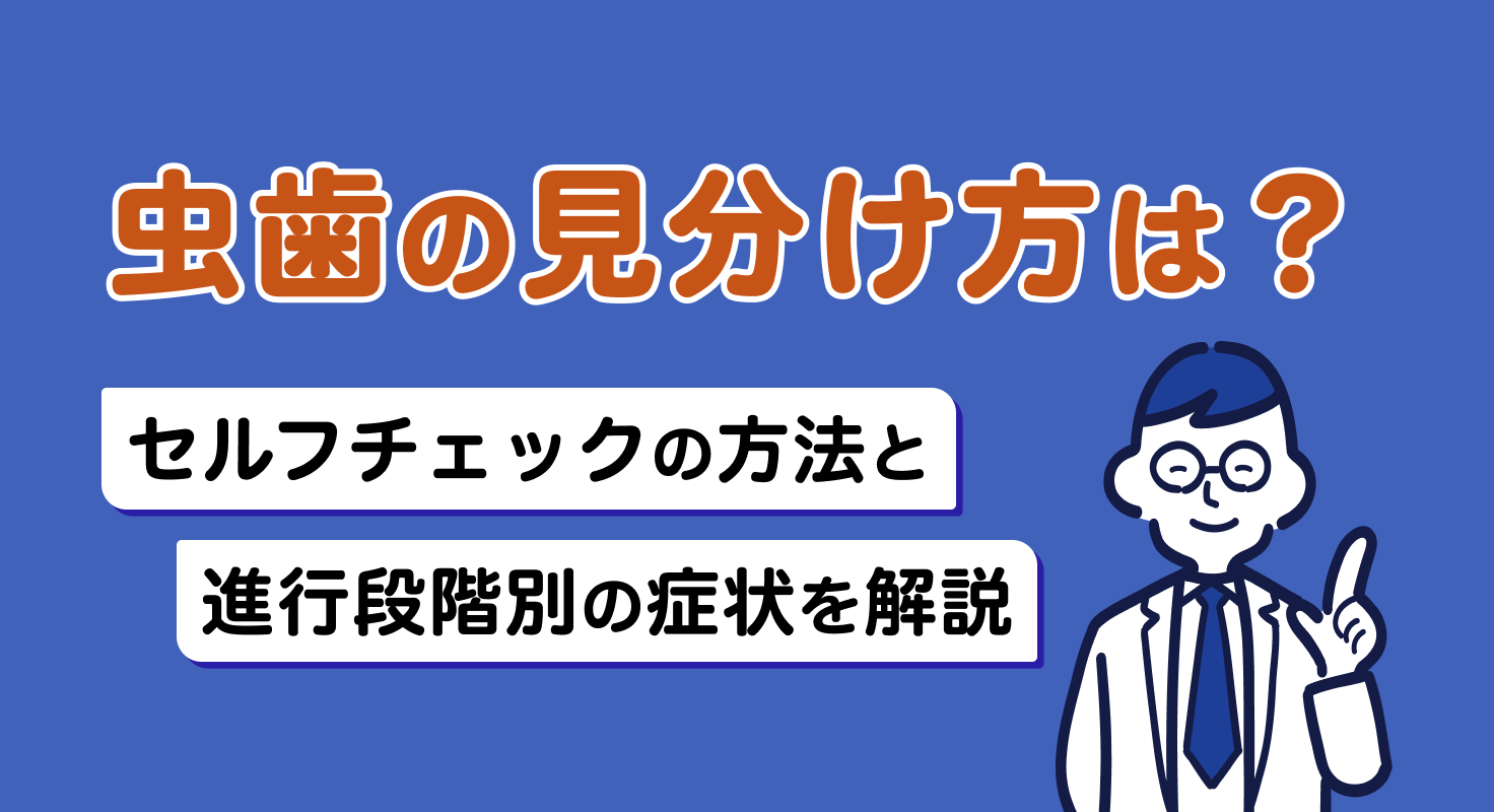 虫歯の見分け方は？セルフチェックの方法と進行段階別の症状を解説