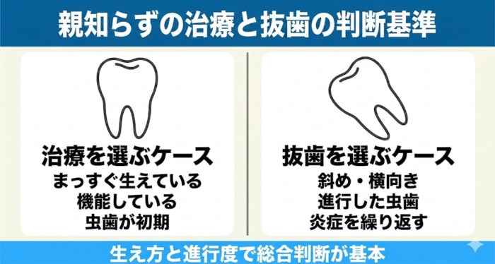 親知らずの治療と抜歯の判断基準の図解