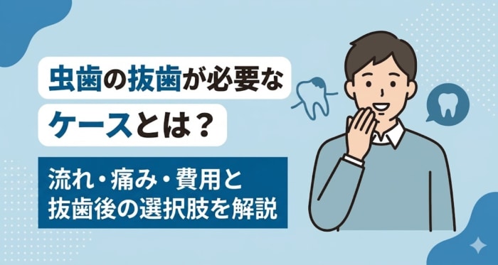 虫歯の抜歯が必要なケースとは？流れ・痛み・費用と抜歯後の選択肢を解説