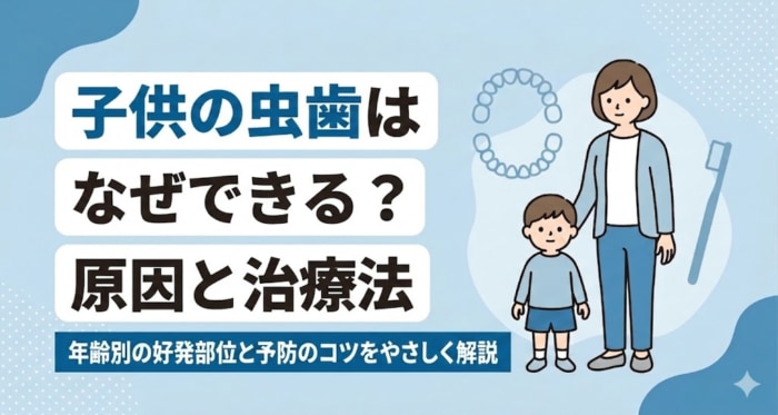 子供の虫歯はなぜできる？原因・年齢別の好発部位と治療・予防をやさしく解説