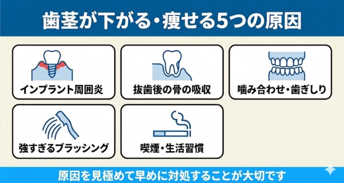 インプラントで歯茎が下がる・痩せる主な原因を5つのカードで整理した図解。インプラント周囲炎・骨吸収・噛み合わせ・強いブラッシング・喫煙が歯茎の退縮につながることを示す。