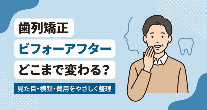 歯列矯正のビフォーアフターでどこまで変わる？見た目・横顔・費用をやさしく整理