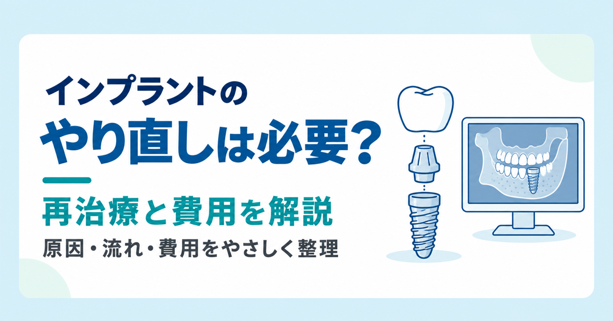 インプラントのやり直しは必要？再治療と費用を解説する記事のアイキャッチ画像